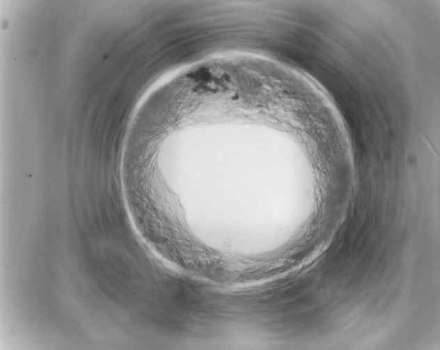 X0000085261199200704092106