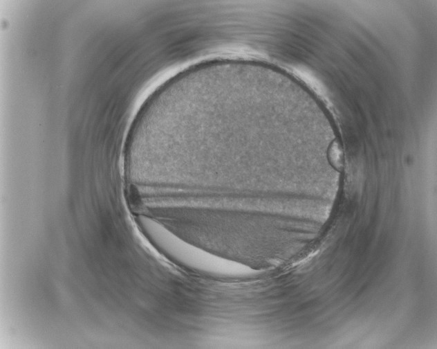 X0000085261335200704092104