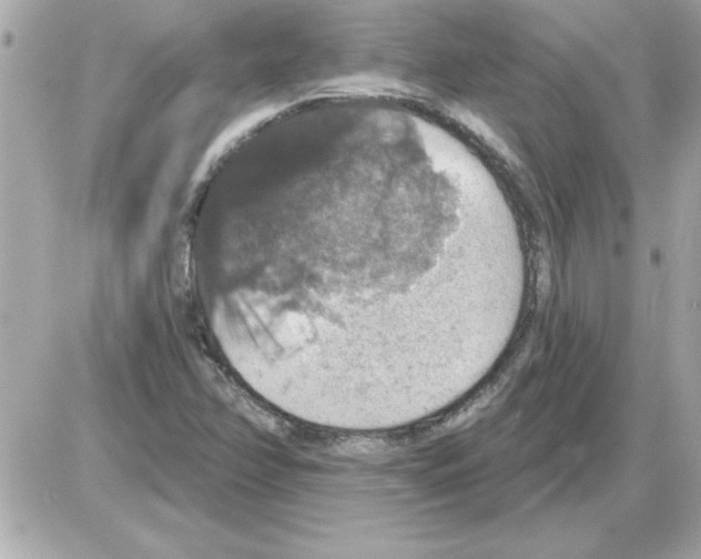 X0000085261358200704092104