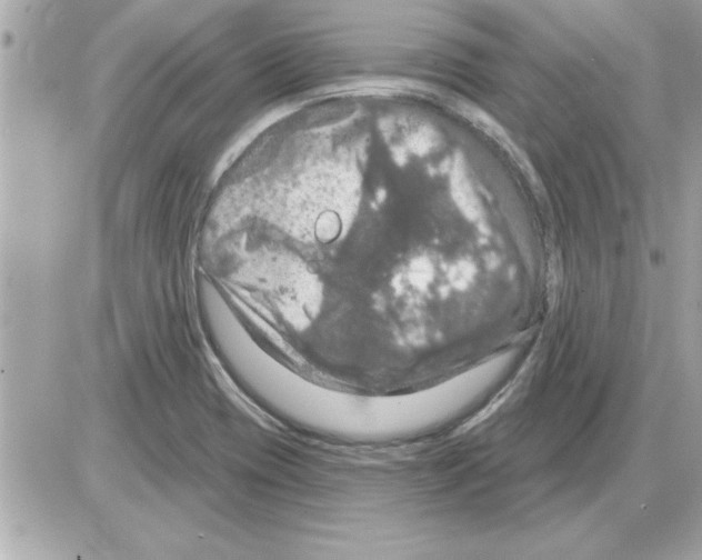 X0000085261417200704092103