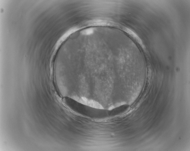 X0000085261419200704092103