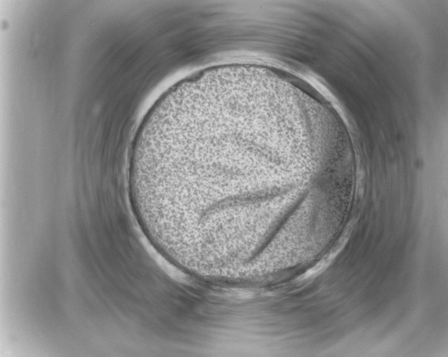 X0000085261438200704092103