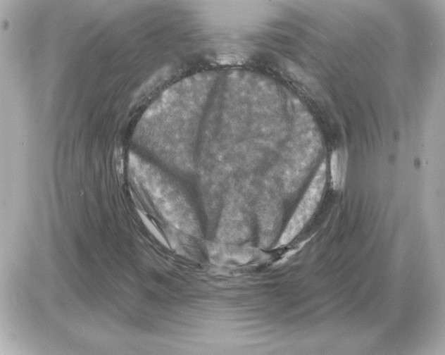 X0000085261443200704092102