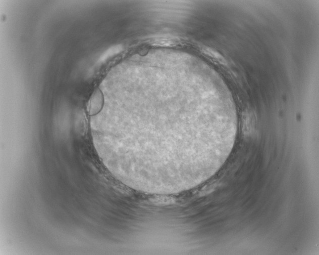 X0000085261446200704092102