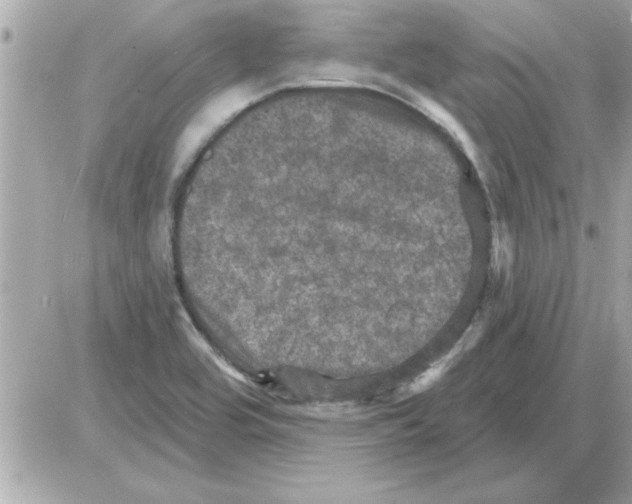 X0000085261464200704092102