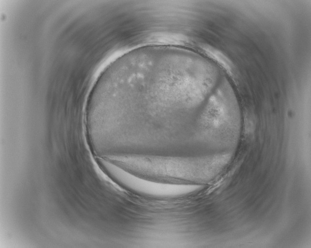 X0000085261471200704092102