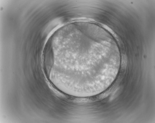 X0000085261474200704092102