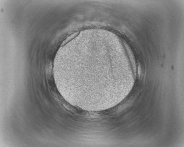 X0000085261492200704092101