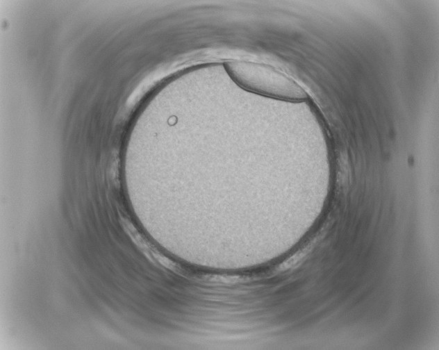 X0000085261499200704092101