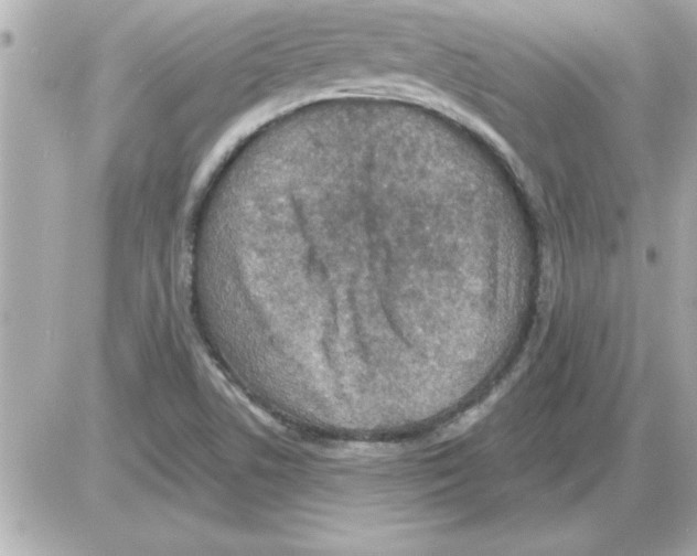 X0000085261506200704092101