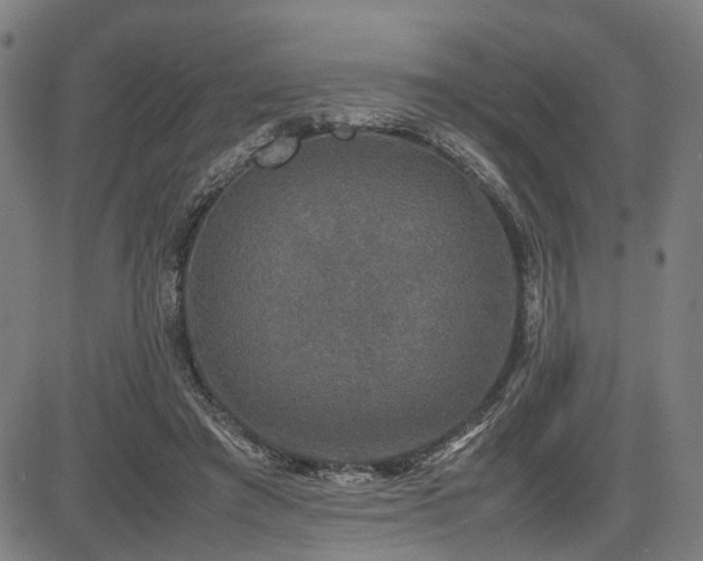 X0000085270401200703091357