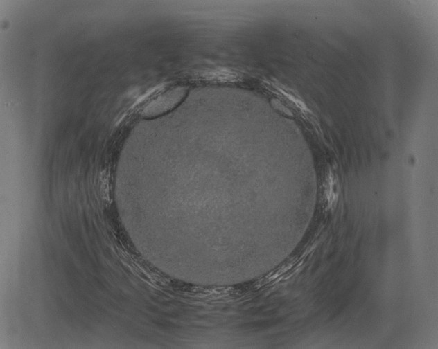 X0000085271205200703091343