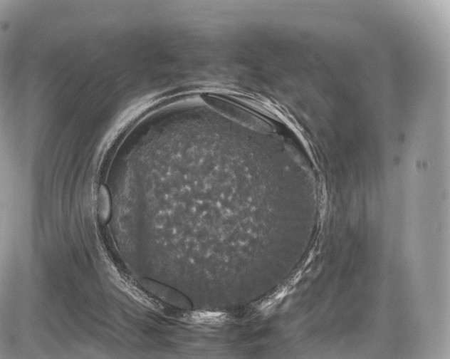 X0000085270055200703161440