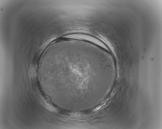 X0000085270105200703161440