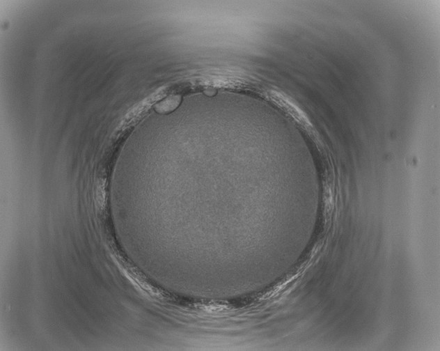 X0000085270401200703161435