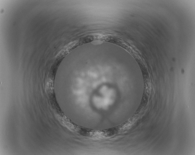 X0000085270419200703161435