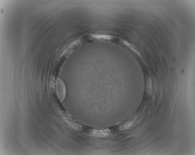 X0000085270571200703161433