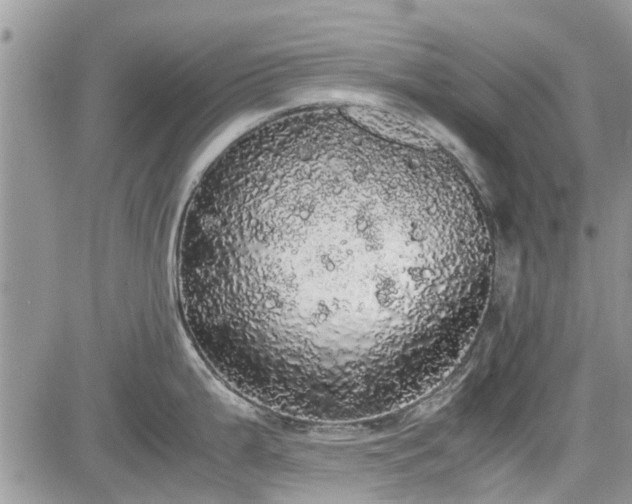 X0000085271199200703161421