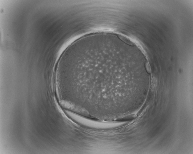 X0000085271295200703161420