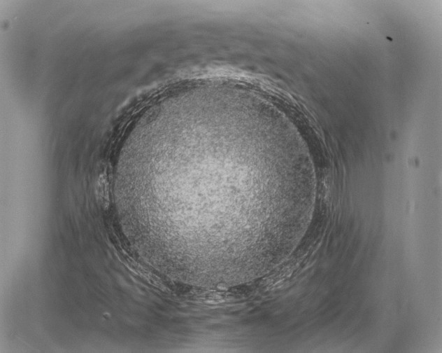 X0000085271493200703161416