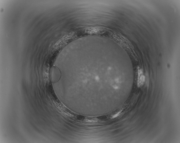 X0000085270510200703231744