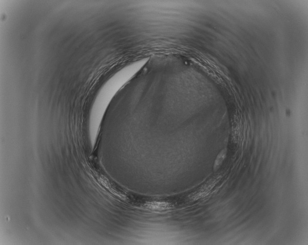 X0000085270748200703231740