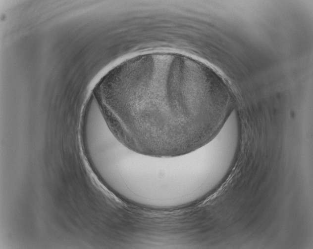 X0000085271518200703231728