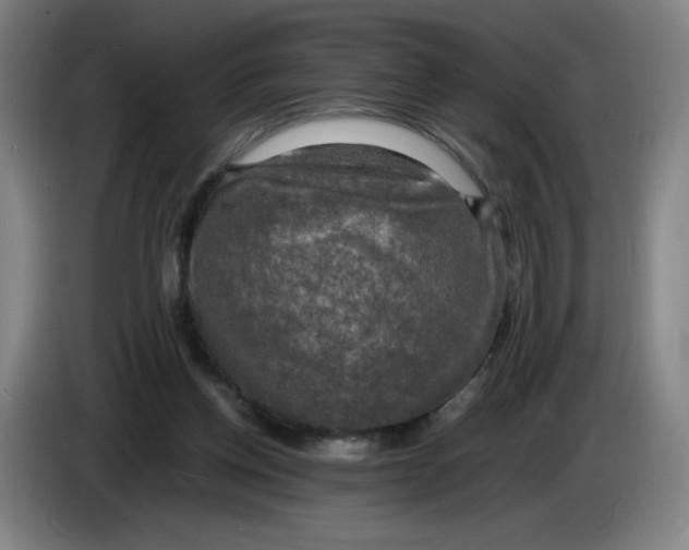 X0000085270158200703301902