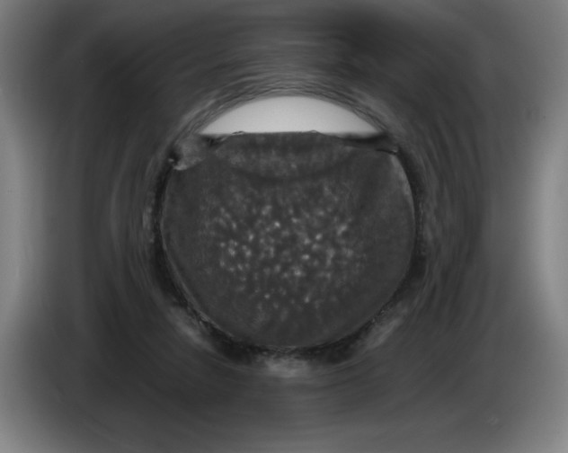 X0000085270258200703301900