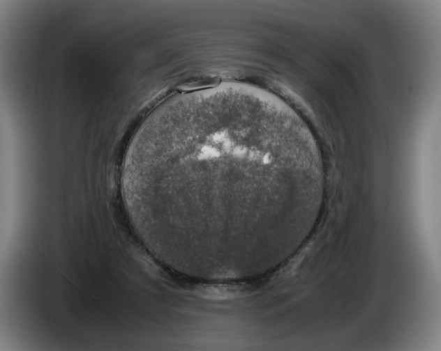 X0000085270305200703301900