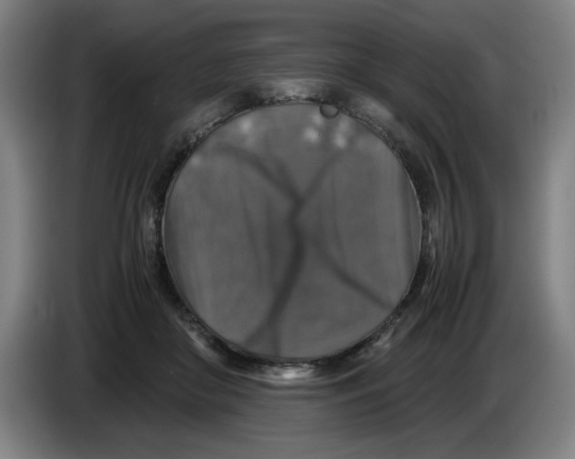 X0000085270410200703301858