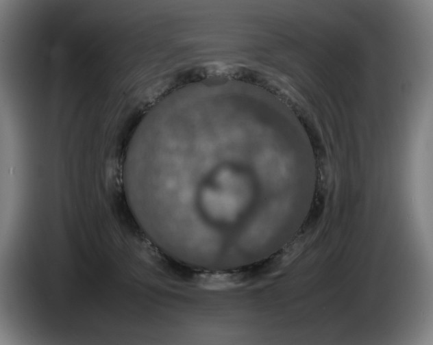 X0000085270419200703301858