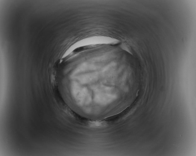 X0000085270432200703301858