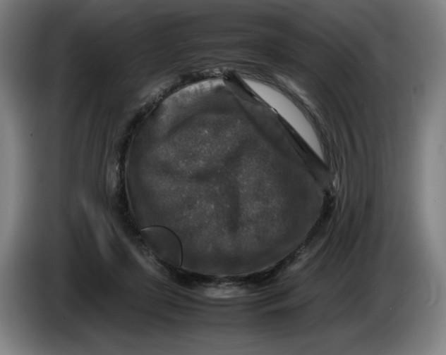 X0000085270451200703301858