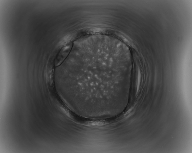 X0000085270462200703301858