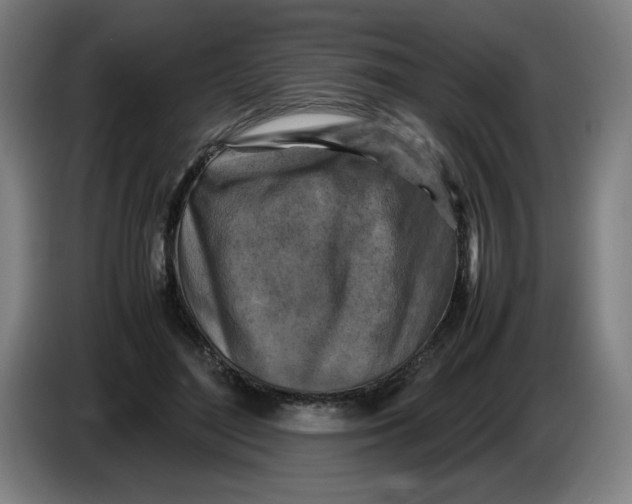 X0000085270500200703301857