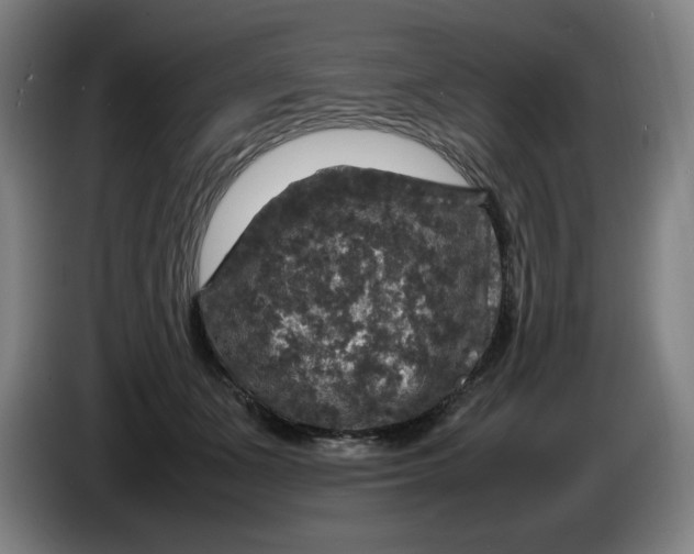 X0000085270511200703301857