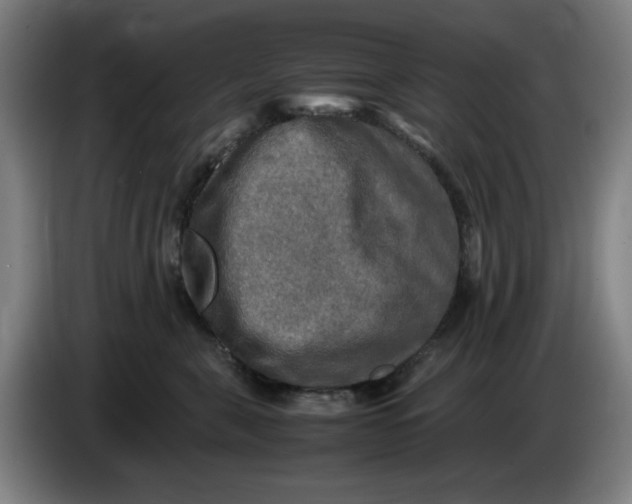 X0000085270571200703301857