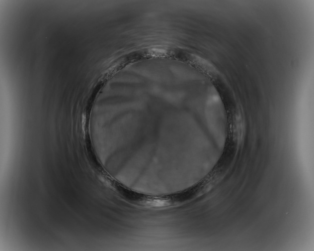 X0000085270610200703301856