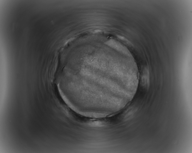 X0000085270620200703301855