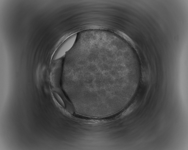 X0000085270938200703301851