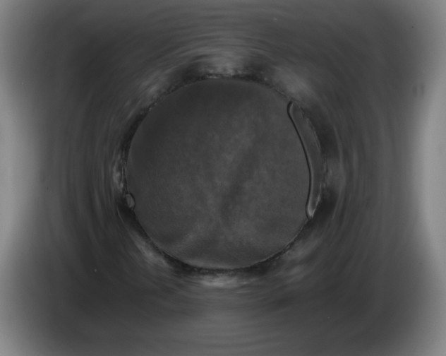 X0000085271202200703301847