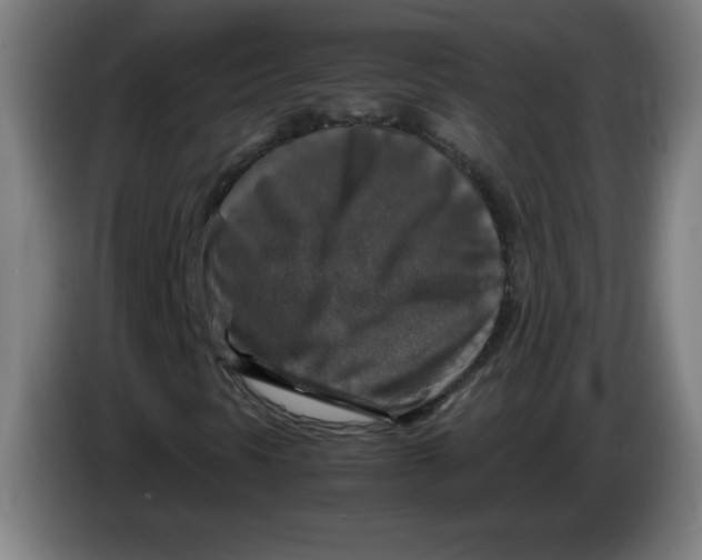 X0000085271297200703301845