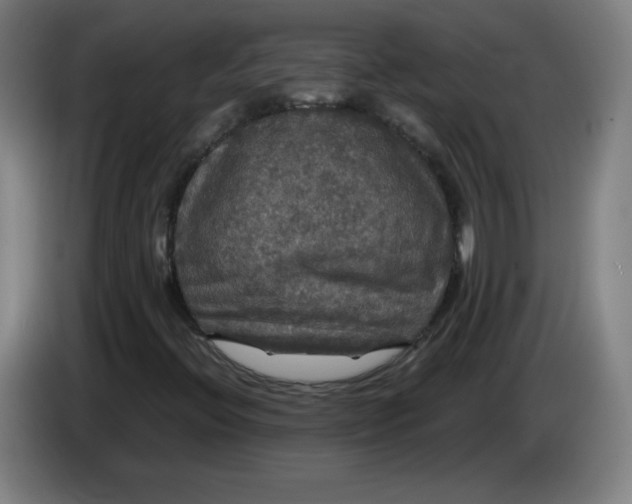 X0000085271396200703301844