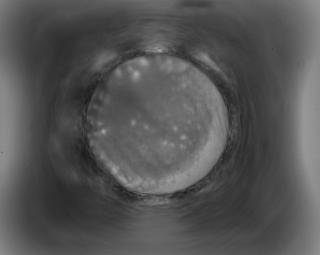 X0000085271446200703301844