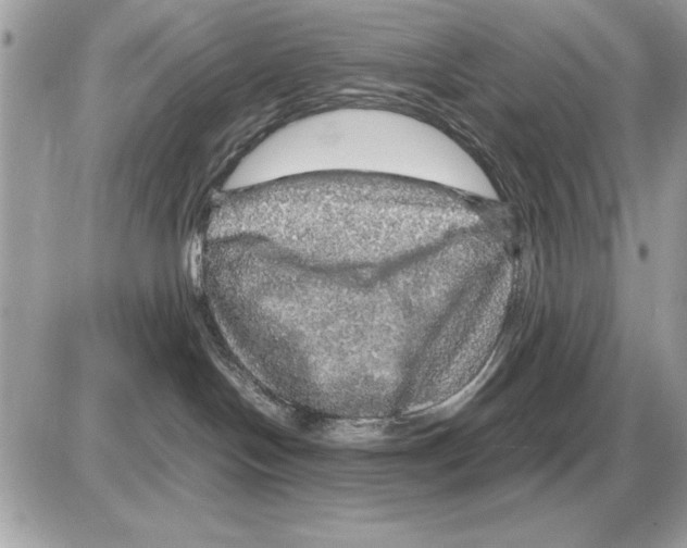 X0000085270094200704092151