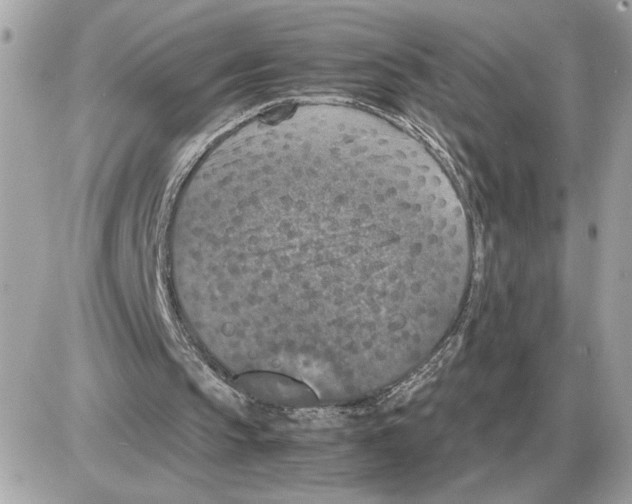 X0000085270145200704092149