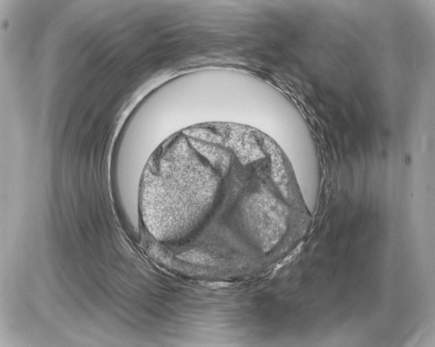 X0000085270148200704092149