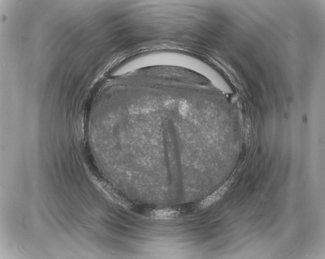 X0000085270158200704092149