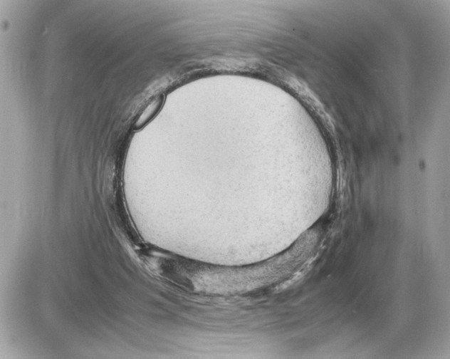 X0000085270201200704092148